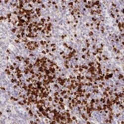 MEKK3 Antibody, Novus Biologicals 25 &mu;L, Unlabeled:Antibodies, Polyclonal
